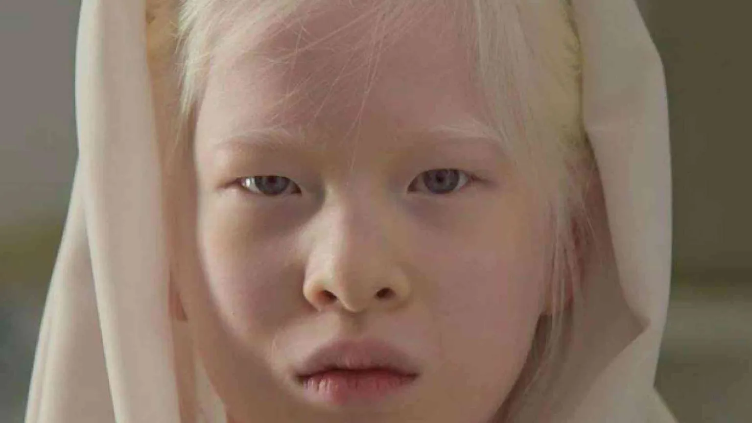 Xueli, la bambina albina abbandonata diventa modella