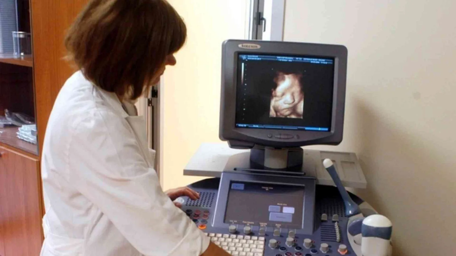 Aborti selettivi, caso a Treviso. «Neonati Down spariti»