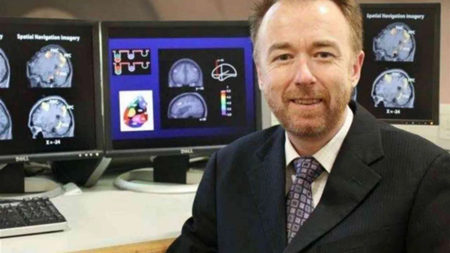 Owen: ogni individuo è diverso, serve prudenza a staccare il sondino