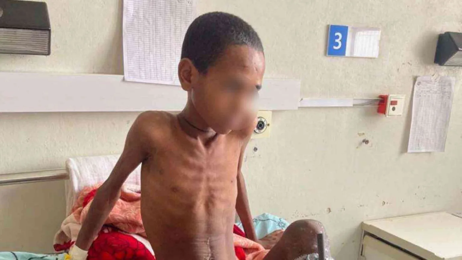 Sos dal Tigrai, aumentano le piccole vittime della fame