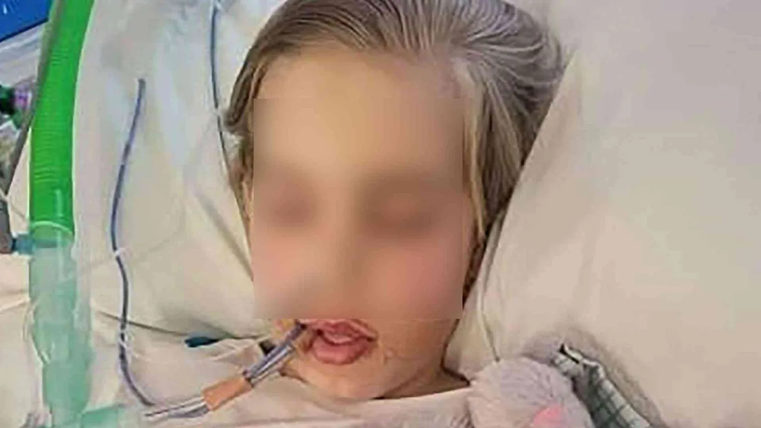 Bimbo in coma. I giudici: «Si stacchi la spina»