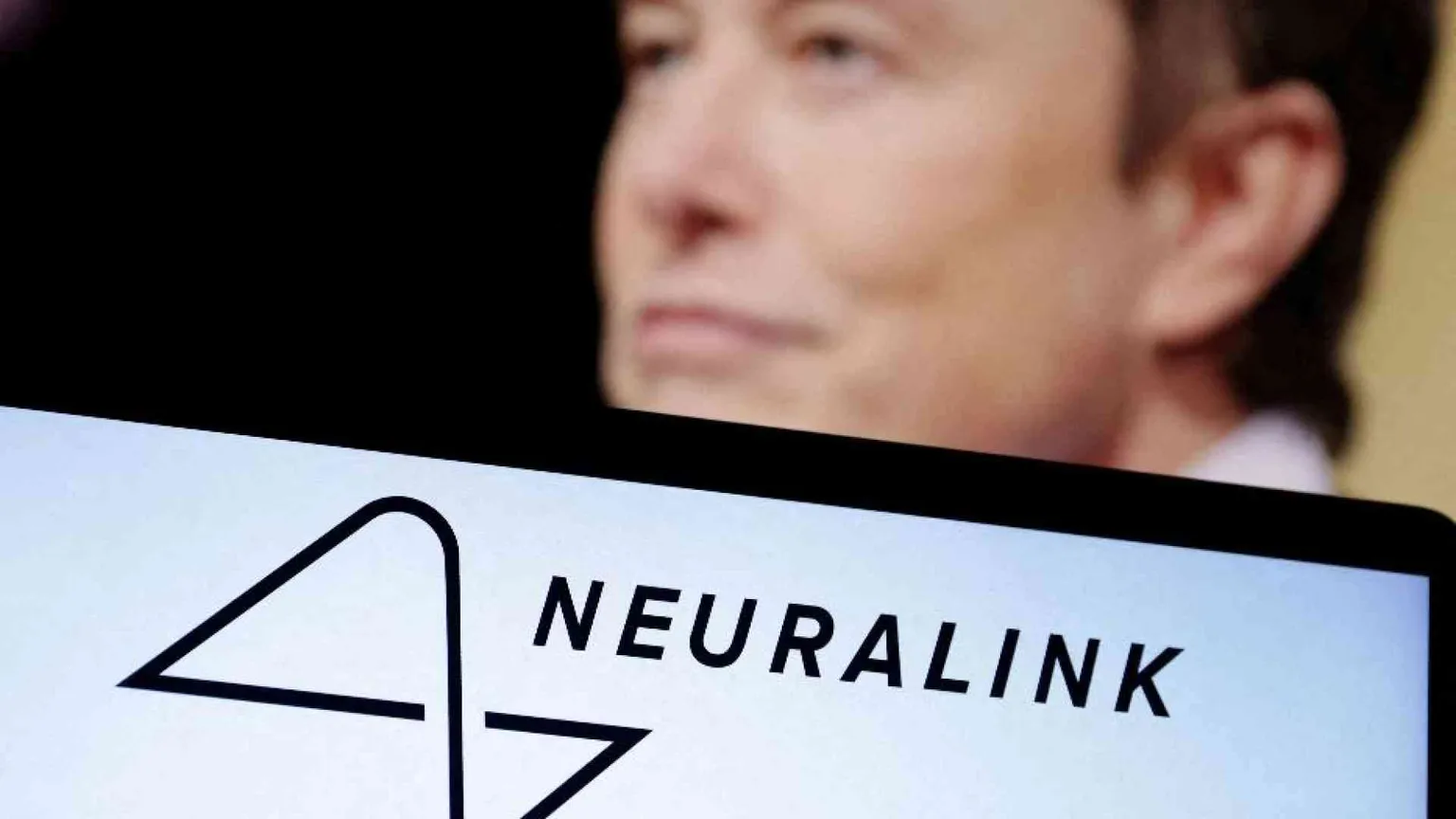 Un'azienda di Musk autorizzata a impiantare chip nel cervello