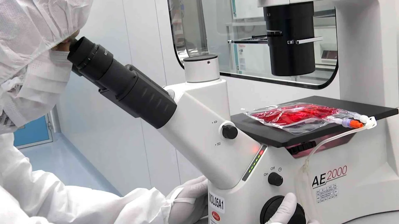 Cellule Car-T in ragazzi con gravi malattie autoimmuni: stanno bene