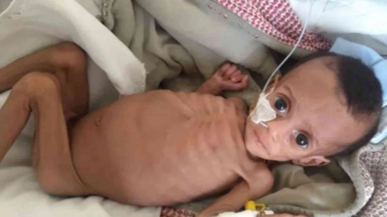 Tigrai 2024, la fame dimenticata: così muoiono in silenzio mamme e neonati