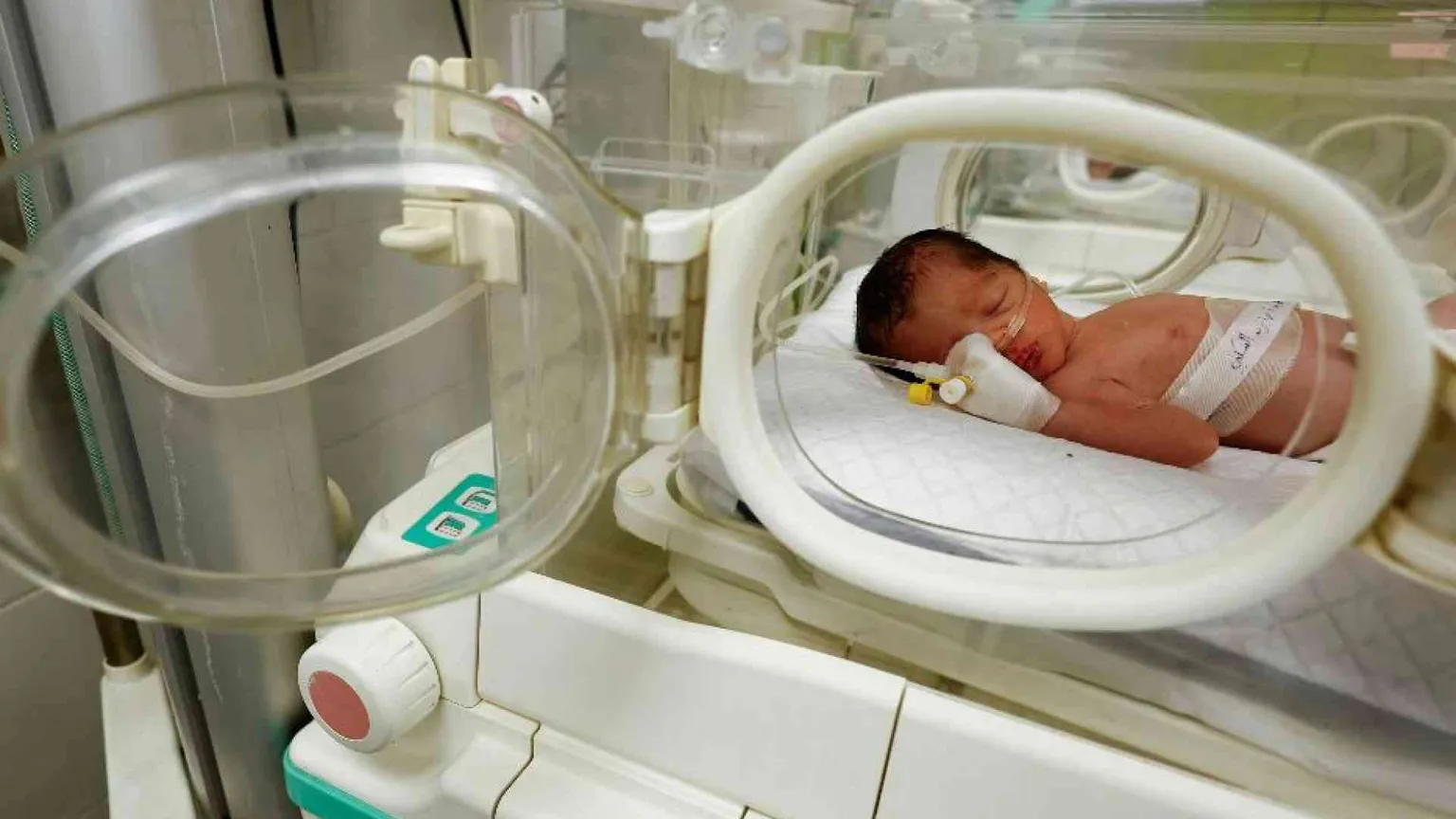Non ce l'ha fatta Sabreen, la neonata estratta viva dal corpo della madre