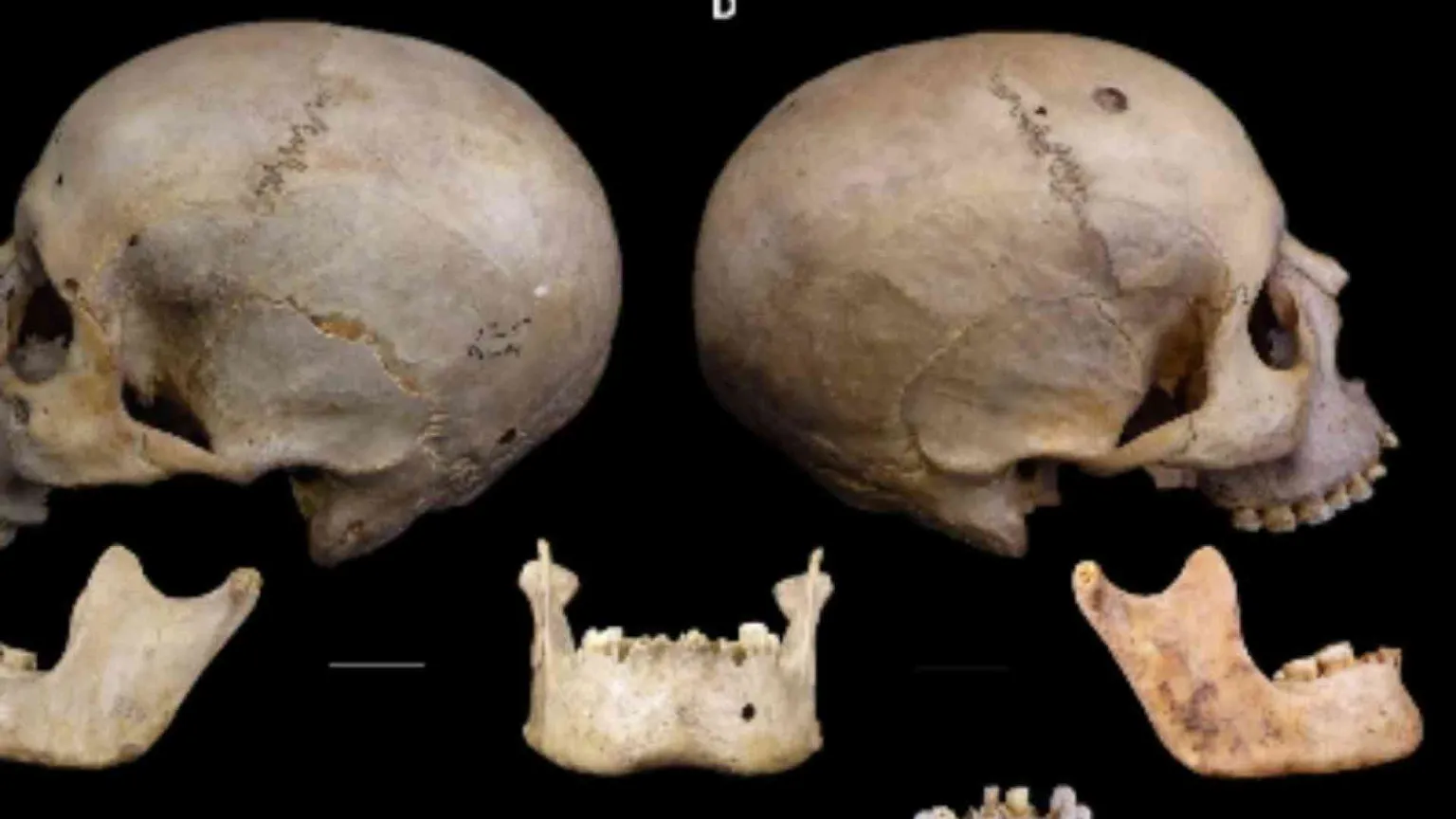 Il cancro era conosciuto nell'antichità e gli Egizi sapevano anche curarlo