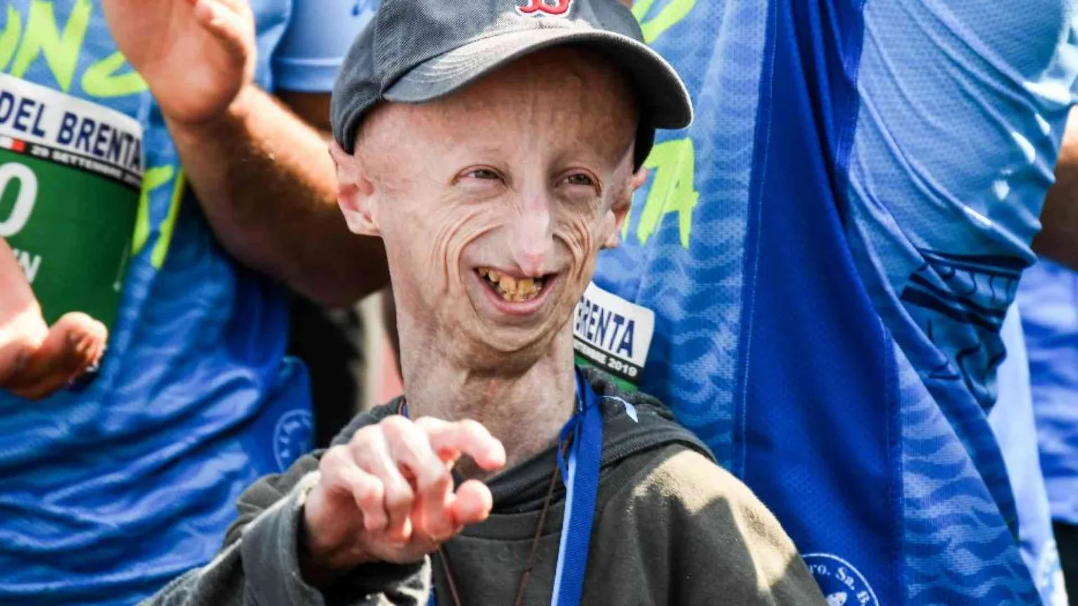 «Che dono la vita»: la lettera scritta da Sammy Basso per il suo funerale