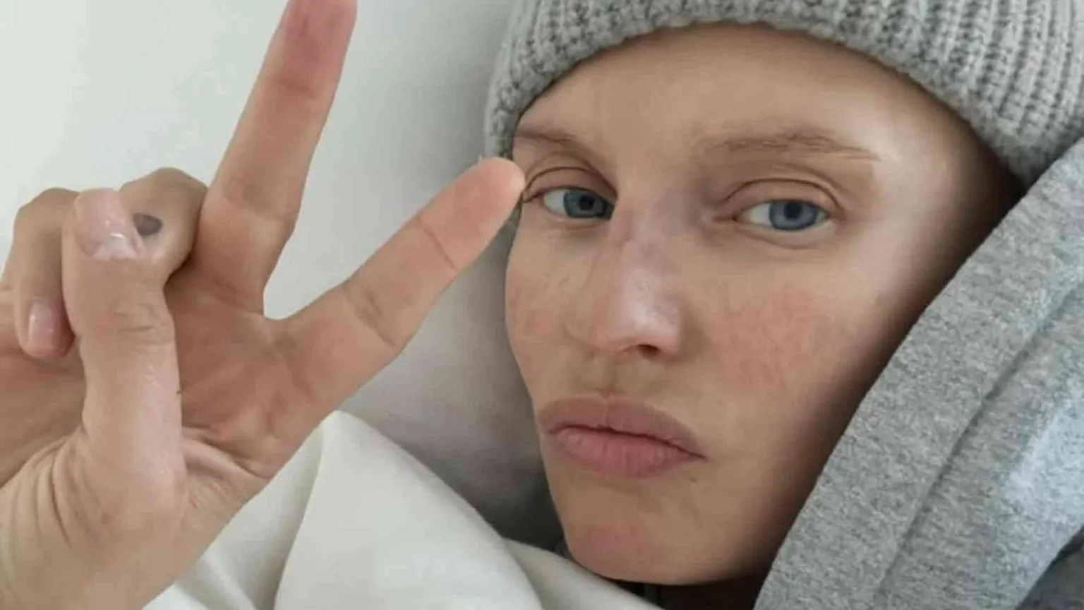 Bianca Balti a Sanremo, la malattia raccontata col sorriso
