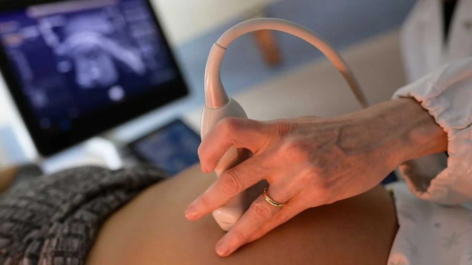 Bimba con un tumore di 800 grammi salvata intevenendo prima e dopo la nascita