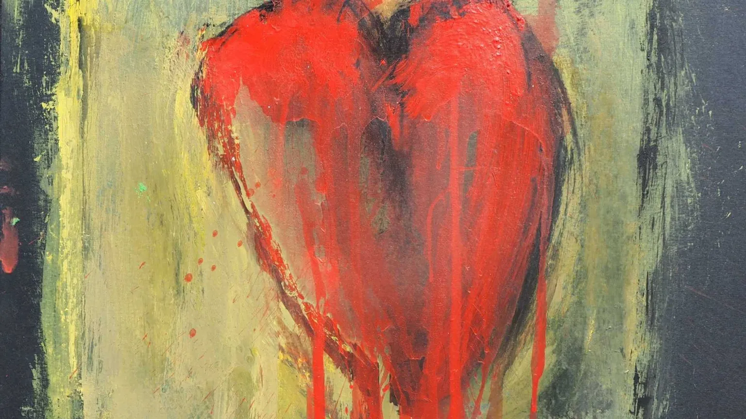 Cardiopatie congenite: una mostra fatta col cuore