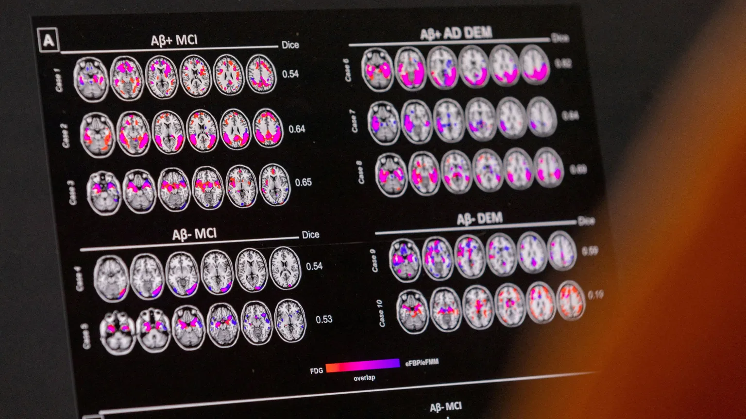 86 miliardi di neuroni “svelano” i nostri pensieri