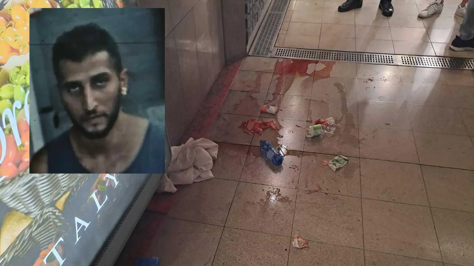 Il racconto della ragazza sfregiata a Milano: «Ho temuto di morire»