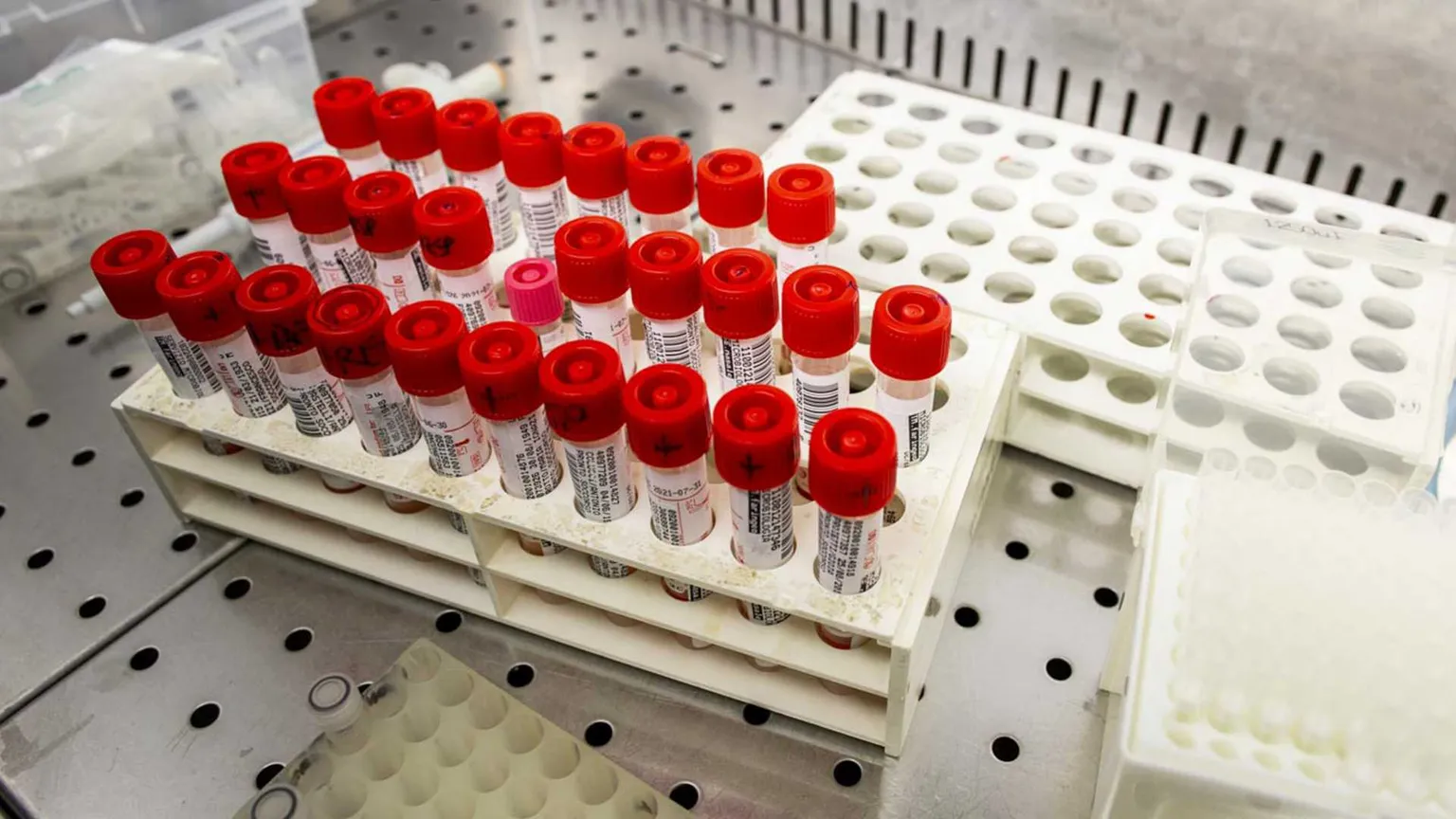 Una molecola non basta più: l’Intelligenza artificiale “custode” dei nuovi farmaci?