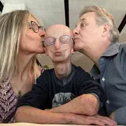 I genitori di Sammy Basso: «Ci ha insegnato a vivere una vita piena»