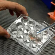 Cos’è la “tolleranza immunitaria” e perché è una scoperta da Nobel