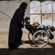 Tende infestate di topi e parassiti, malformazioni: le piaghe di Gaza