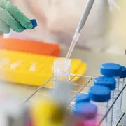 Meno ricerca oncologica in Italia per burocrazia e regole Usa