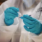 Epatiti, in Italia mortalità in calo