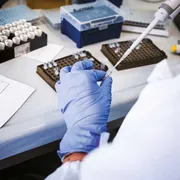 «Previene recidive e diffusione»: perché tutti stanno parlando del vaccino contro il melanoma