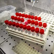 Una molecola non basta più: l’Intelligenza artificiale “custode” dei nuovi farmaci?