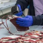 Donazioni di sangue all'ospedale Niguarda di Milano / ANSA