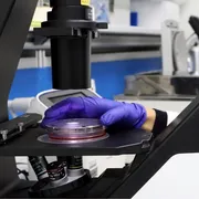 In Francia rilevato il virus Shamonda in un essere umano: è la prima volta. Cosa c'è da sapere