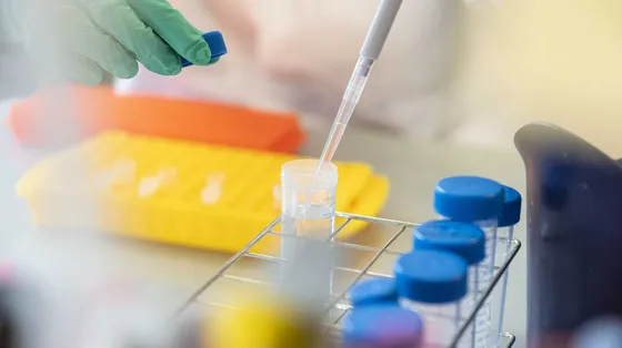 Meno ricerca oncologica in Italia per burocrazia e regole Usa