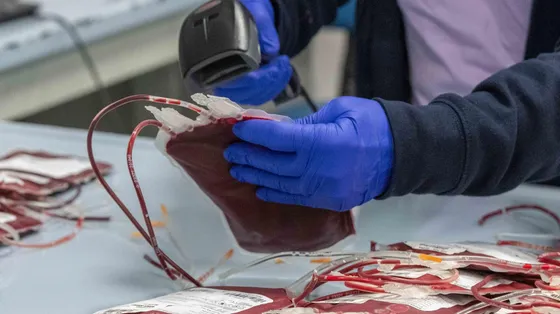 Donazioni di sangue all'ospedale Niguarda di Milano / ANSA