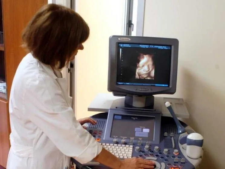 Aborti selettivi, caso a Treviso. «Neonati Down spariti»