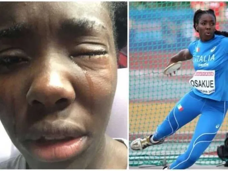Dopo l'aggressione, Daisy Osakue: volevano colpire una ragazza di colore