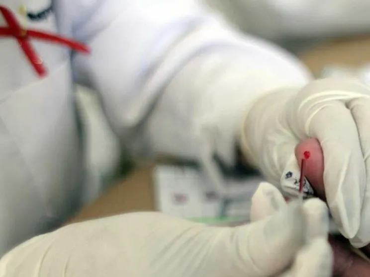 Giovane ricercatrice contagiata in laboratorio da virus dell'Hiv