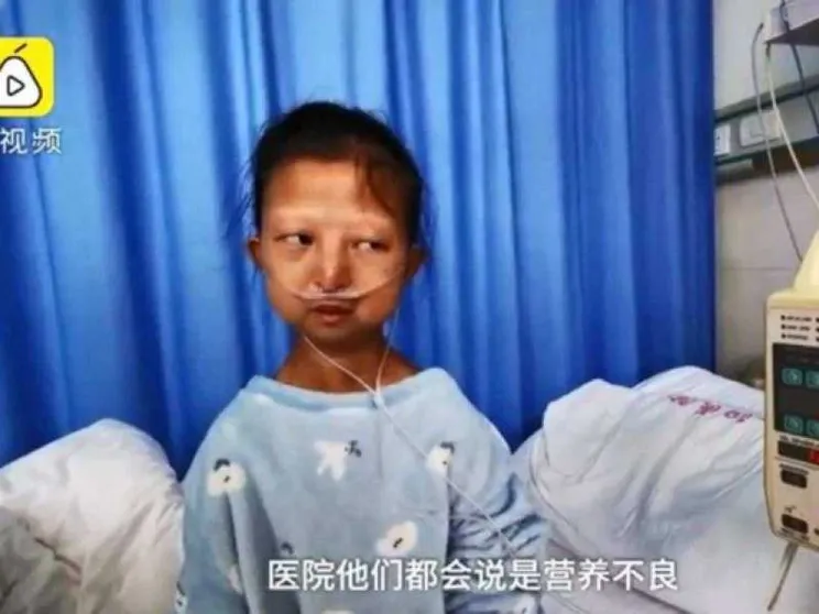 L'agonia di Wu Huayan morta di denutrizione per curare il fratello disabile