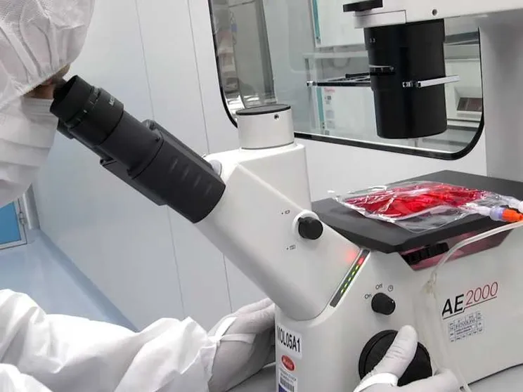 Cellule Car-T in ragazzi con gravi malattie autoimmuni: stanno bene