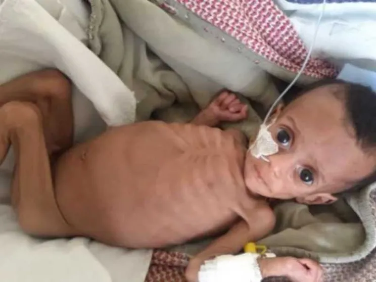 Tigrai 2024, la fame dimenticata: così muoiono in silenzio mamme e neonati