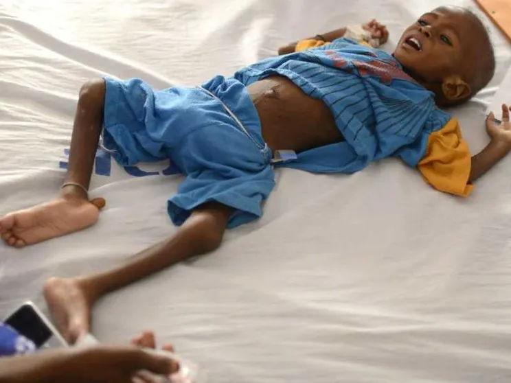L'Onu: il mondo ha risorse per sfamare tutti, ma uno su 10 è senza cibo