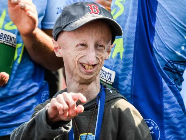 «Che dono la vita»: la lettera scritta da Sammy Basso per il suo funerale