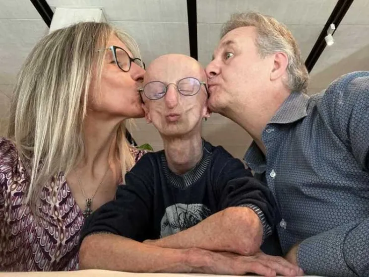 I genitori di Sammy Basso: «Ci ha insegnato a vivere una vita piena»