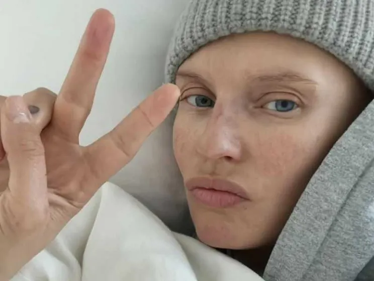 Bianca Balti a Sanremo, la malattia raccontata col sorriso