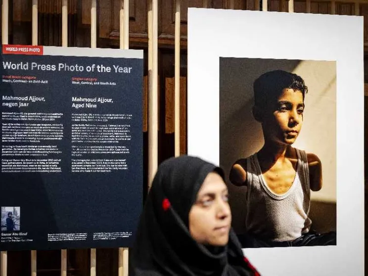 Vince il World Press Photo l'immagine di un bimbo amputato di Gaza