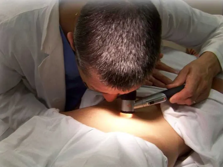 Giovedì 19 a Roma screening dermatologici gratuiti
