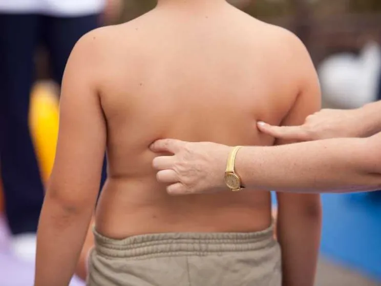 Epidemia di obesità, come si ferma?