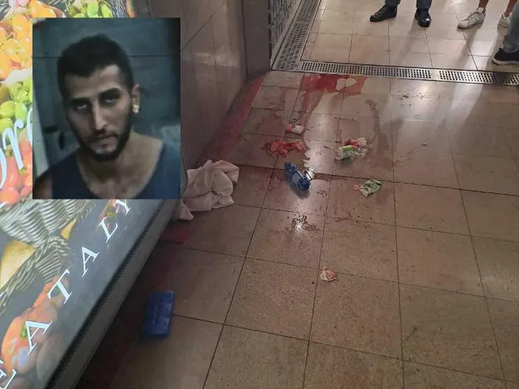 Il racconto della ragazza sfregiata a Milano: «Ho temuto di morire»