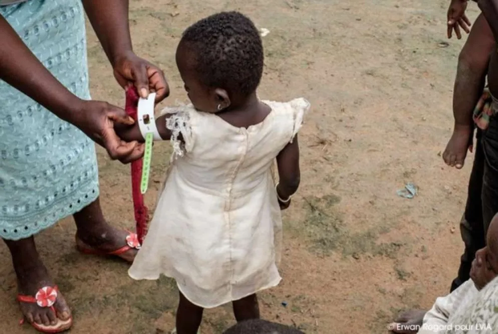 Se la circonferenza del braccio è inferiore a 115 mm, si tratta di malnutrizione acuta severa (MAS): il bambino viene portato al più vicino ambulatorio e curato. I casi più gravi vengono indirizzati all'unico ospedale della regione in cui c'è un pediatra