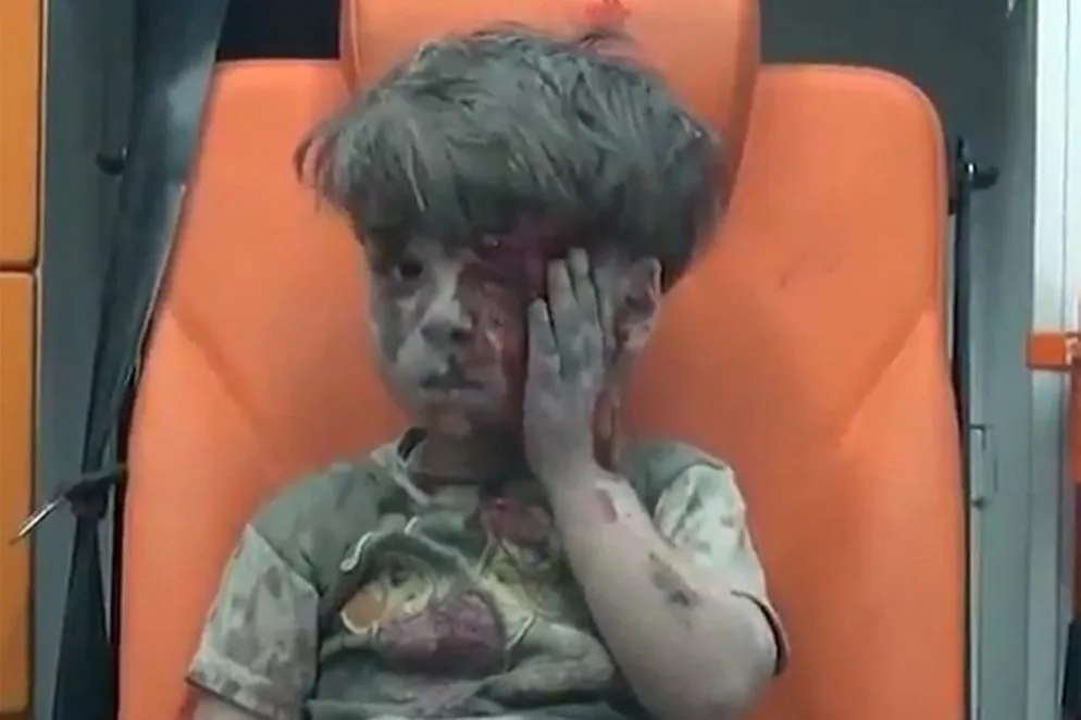 Paura - Omran aveva 5 anni il 17 agosto 2016 quando fu ritratto su una ambulanza