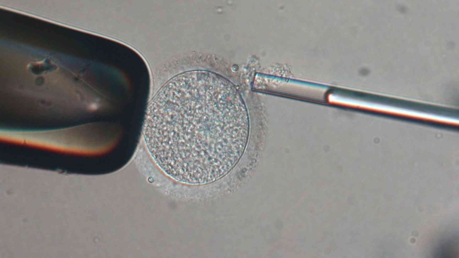 Ovociti: la tratta delle "donatrici" bianche 