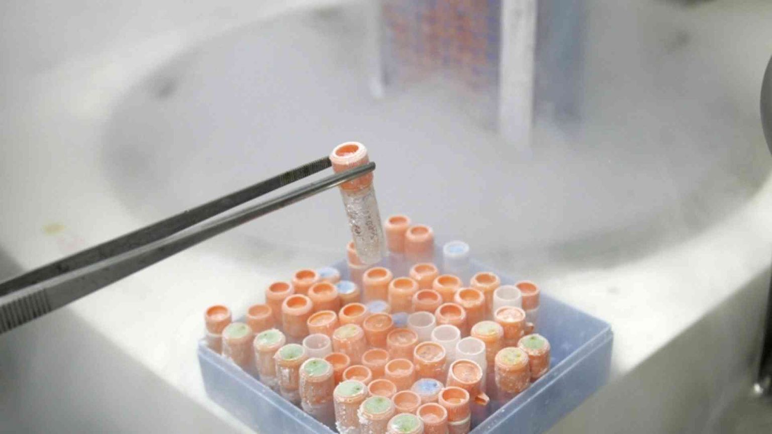 Test sull’embrione e il limite di 14 giorni