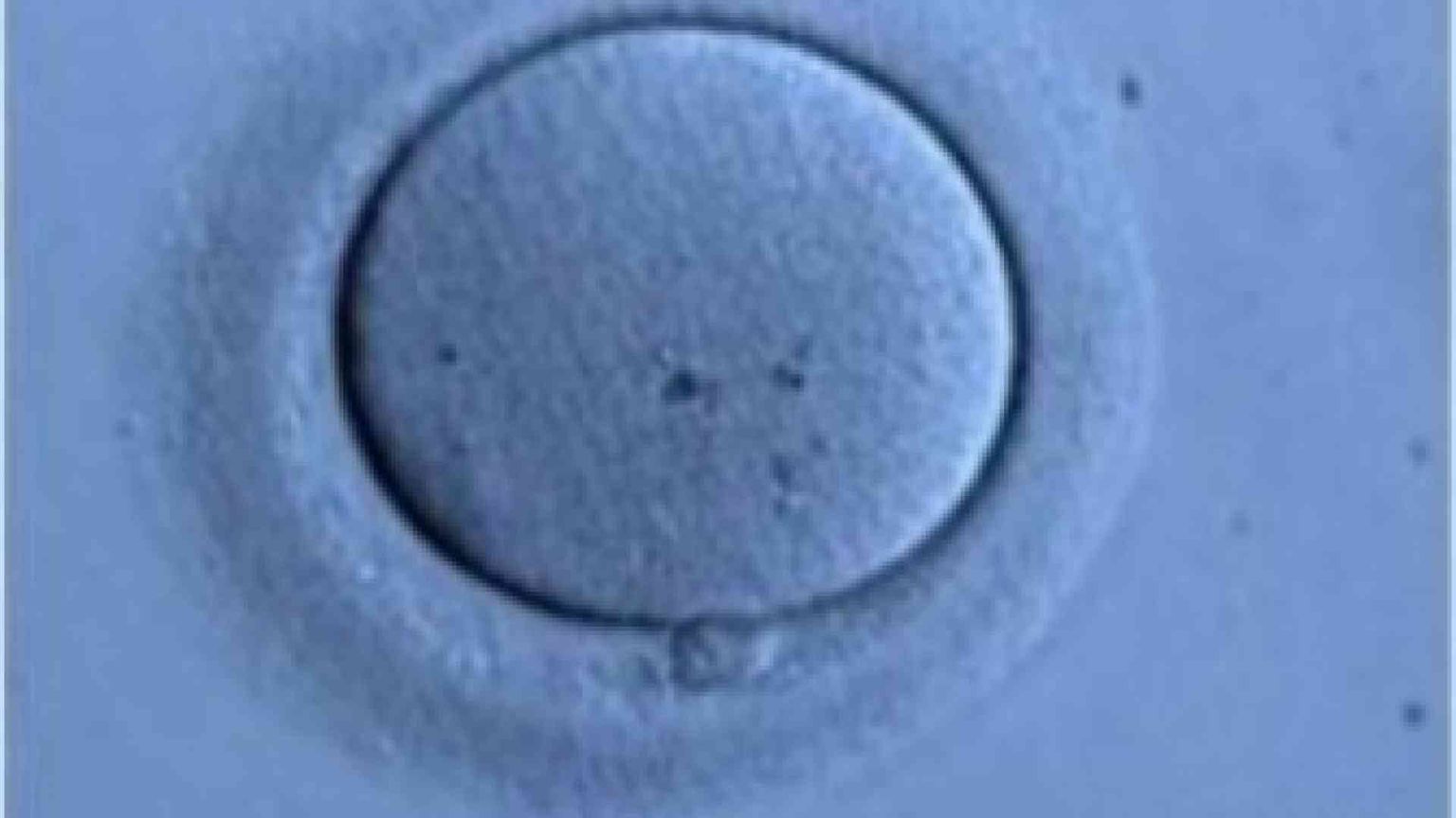 Servono ovociti? Si importano donne