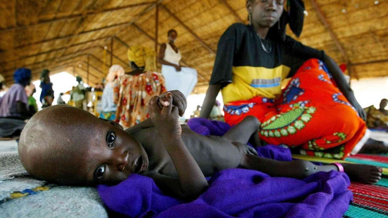 Denutrizione prima malattia dei bimbi in Niger