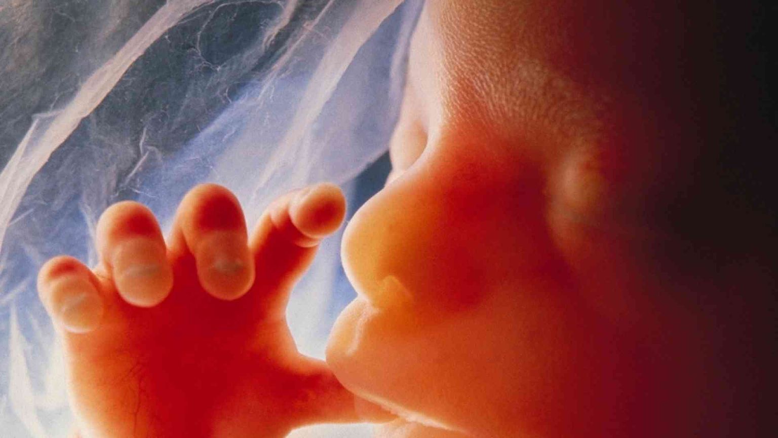 Irlanda, il feto ha molti diritti. Non solo alla vita