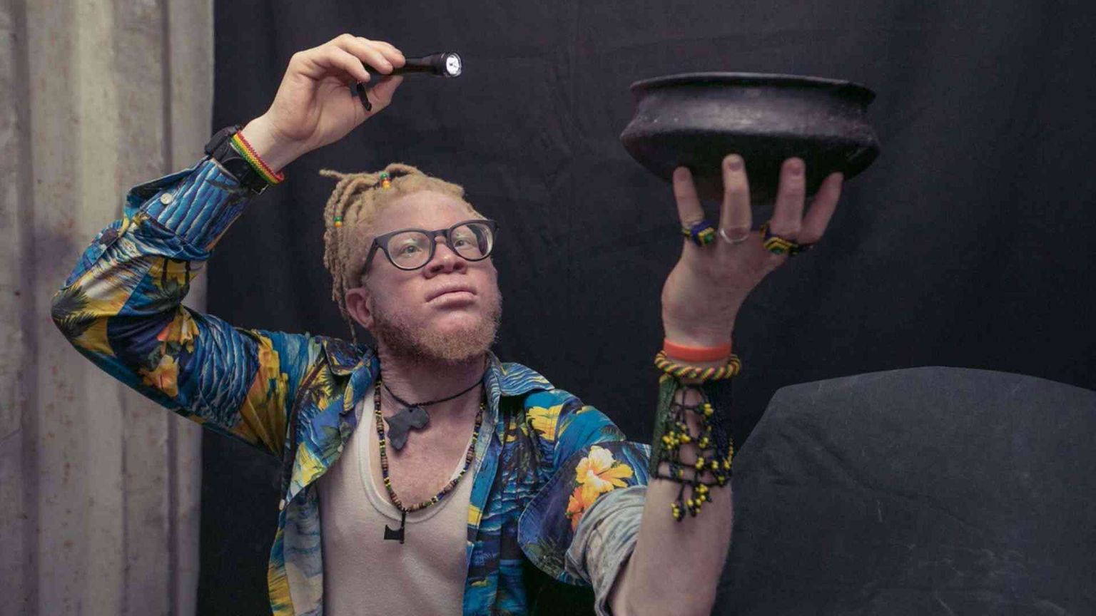 Gli albini «neri» che hanno successo, contro ogni superstizione